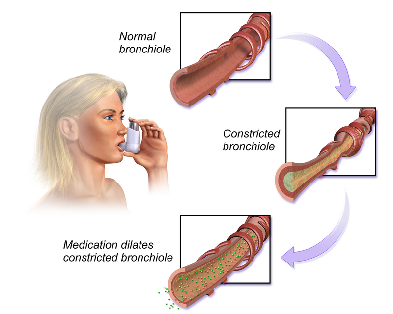 Bronchodilator therapy