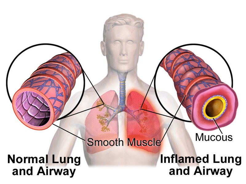 Bronchial receptors in asthma