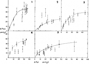 Figure 2. Pulsus paradoxus (change in systolic blood pressure [APsys]) at different magnitudes of swings in pleural pressure (APpl) at FRC (solid circles) and during hyperinflation (ojien circles) in five subjects. Each point of data represents mean for eight consecutive breaths. Bars indicate ±1 SD. Curves were visually fitted through points obtained at FRC.