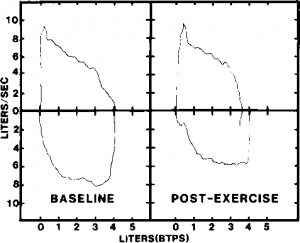 Flow-volume loops