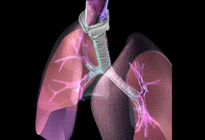 Airway Eosinophilia